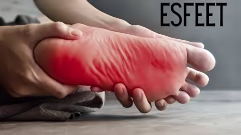 Esfeet